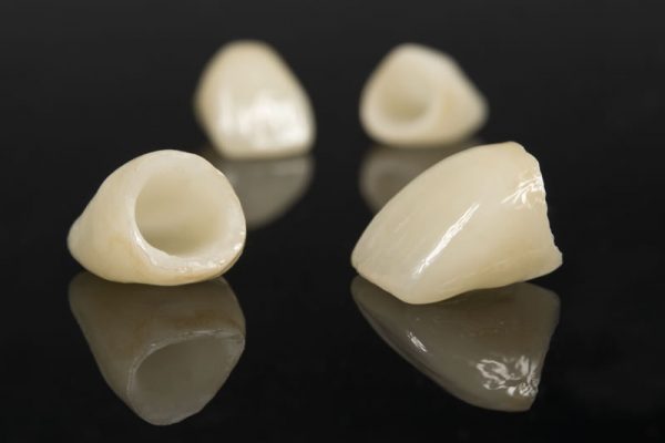 comestic-dentistry-crowns
